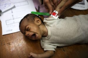 Israel Has Starved at Least 83 Children to Death in Gaza, Health Officials Say 2